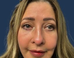 Tommaso Addona, MD, FACS