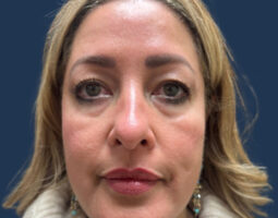 Tommaso Addona, MD, FACS