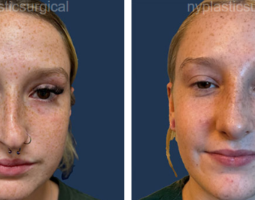 Dr. Noël B. Natoli, MD, FACS