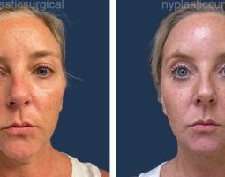 Dr. Noël B. Natoli, MD, FACS