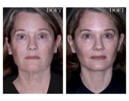 Melissa Doft, MD