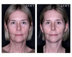 Melissa Doft, MD