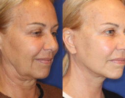Dr. Jennifer Levine