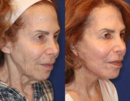 Dr. Jennifer Levine