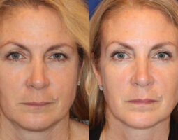 Dr. Jennifer Levine