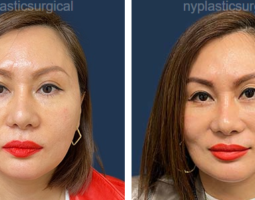 Dr. Noël B. Natoli, MD, FACS
