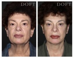 Melissa Doft, MD