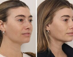 Dr. Jessica Lattman, MD