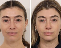Dr. Jessica Lattman, MD