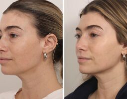 Dr. Jessica Lattman, MD