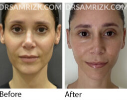 Dr. Sam Rizk, MD