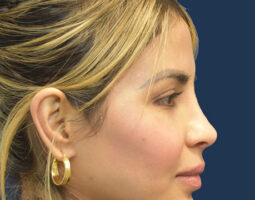 Rachel A. Ruotolo, MD, FACS