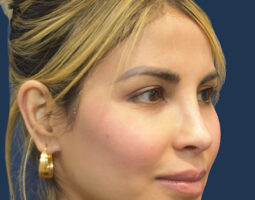 Rachel A. Ruotolo, MD, FACS