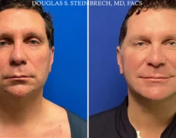 Dr. Douglas Steinbrech