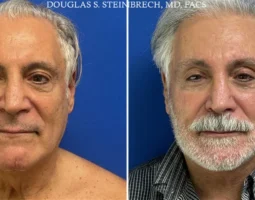 Dr. Douglas Steinbrech