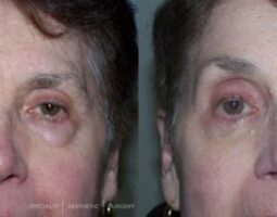 Dr. Anna Frants MD