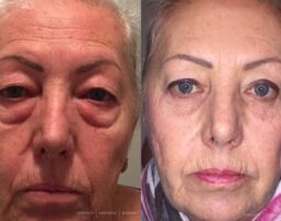 Dr. Anna Frants MD