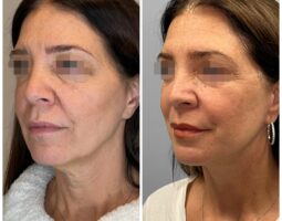 Dr. Marissa Lafer