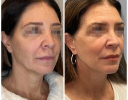 Dr. Marissa Lafer
