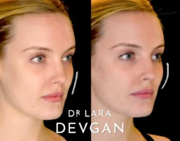 Dr. Lara Devgan, MD, PLLC