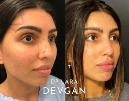 Dr. Lara Devgan, MD, PLLC