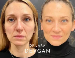 Dr. Lara Devgan, MD, PLLC