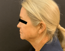 George Ferzli Jr. M.D., FACS