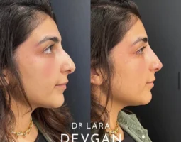 Dr. Lara Devgan, MD, PLLC